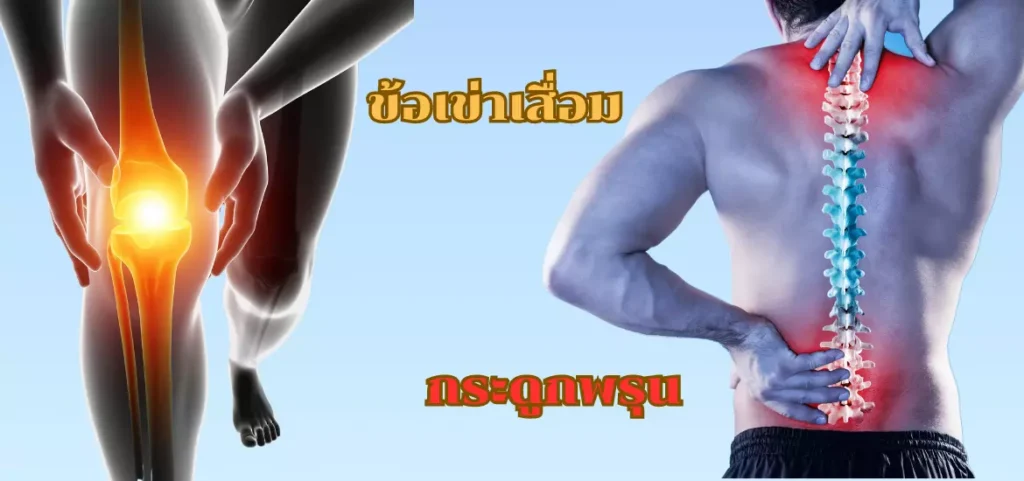 anyconv.com ข้อเข่าเสื่อม