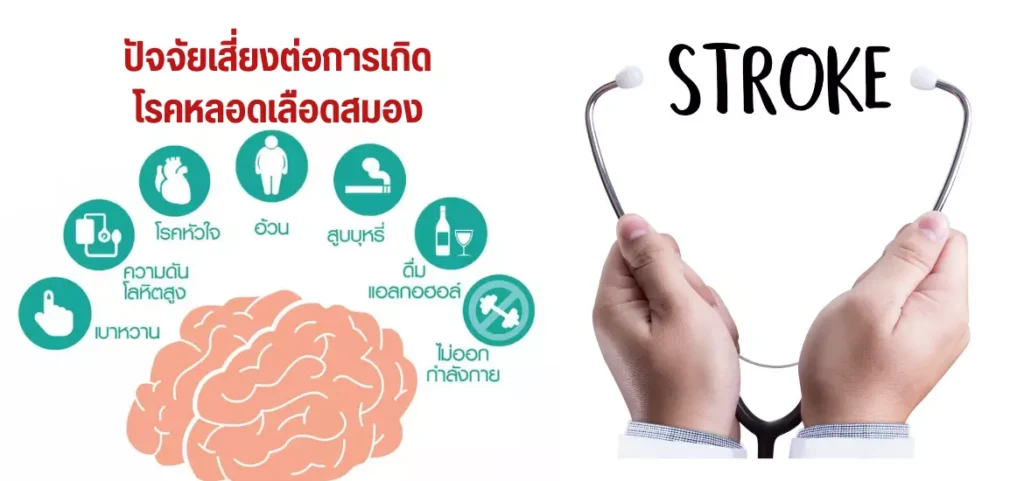 anyconv.com โรคหลอดเลือดสมอง (1)