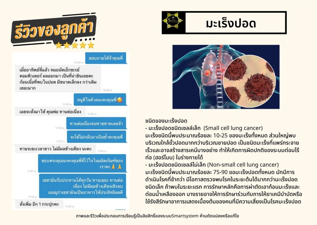 line album ข้อมูล รีวิว ๒๒๐๖๒๓ 22