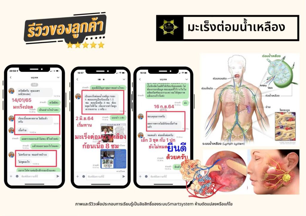 line album รีวิวผู้ป่วยทานจริง 230701 3